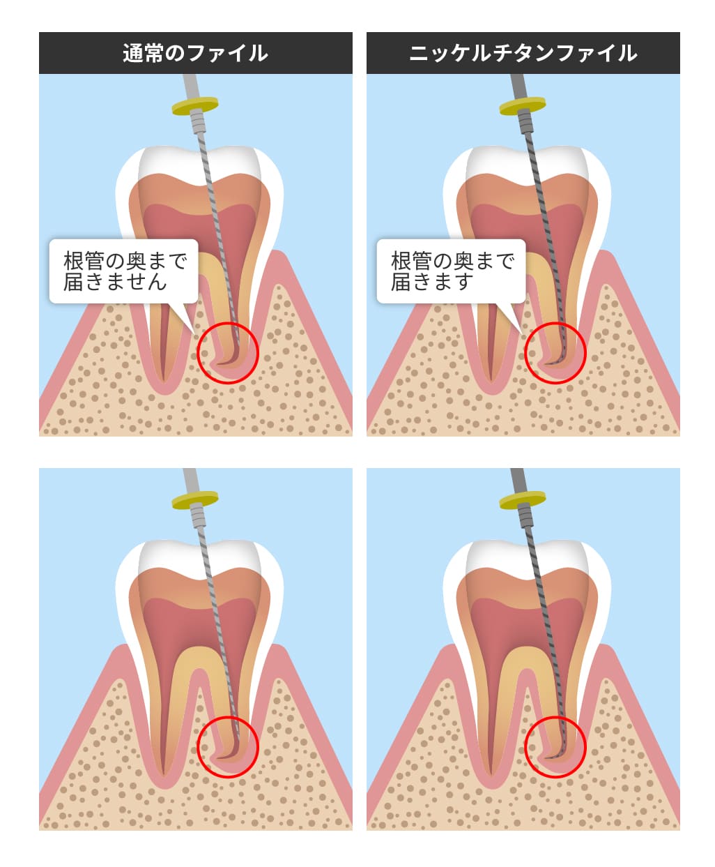 先進的な器具の活用