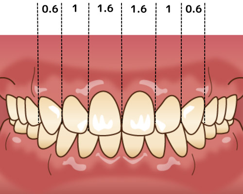 02.審美的な歯の形、バランスに加えて、歯茎の形を考えている