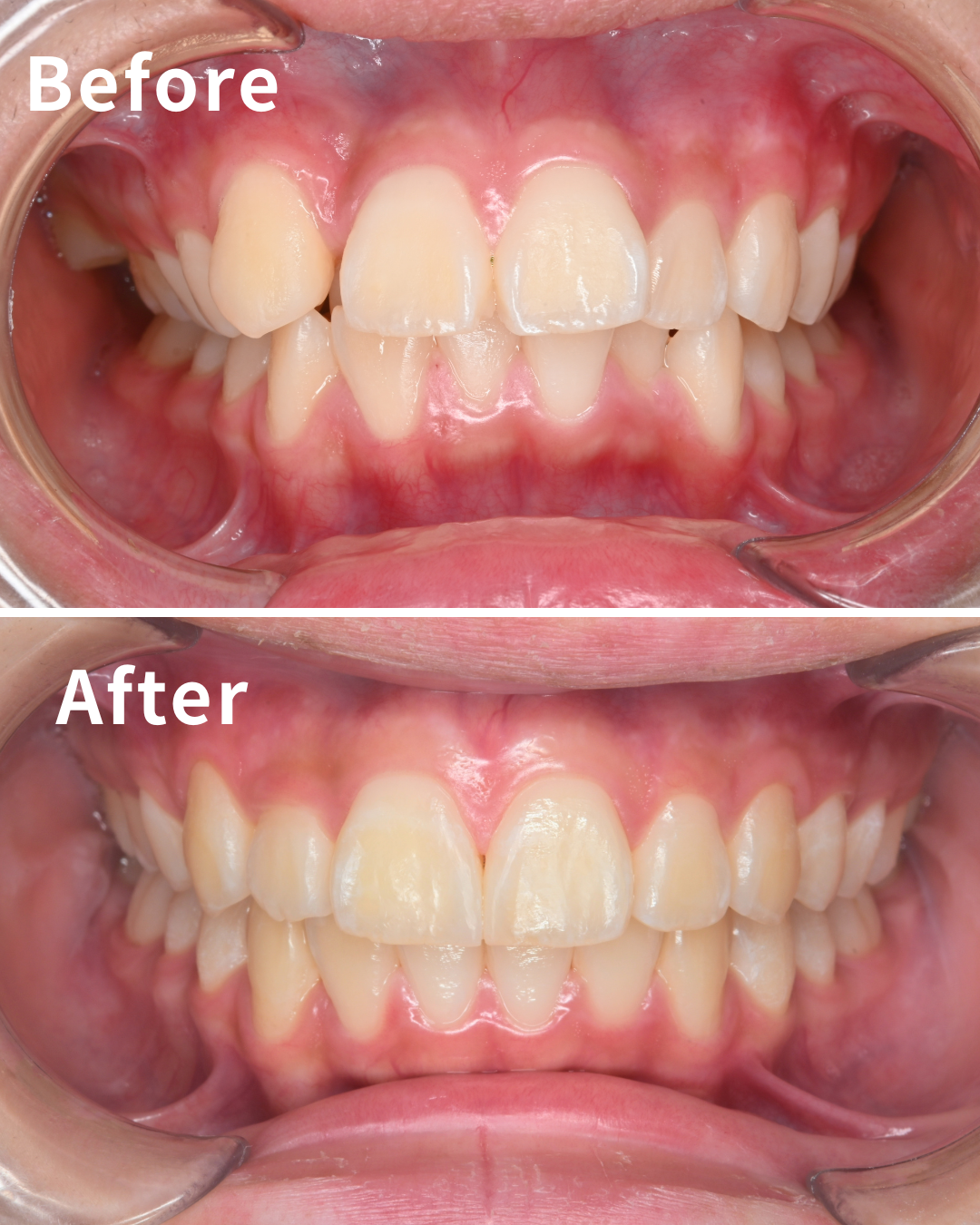 症例のタイトルが入ります。