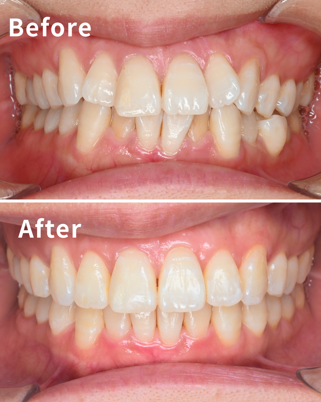 症例のタイトルが入ります。